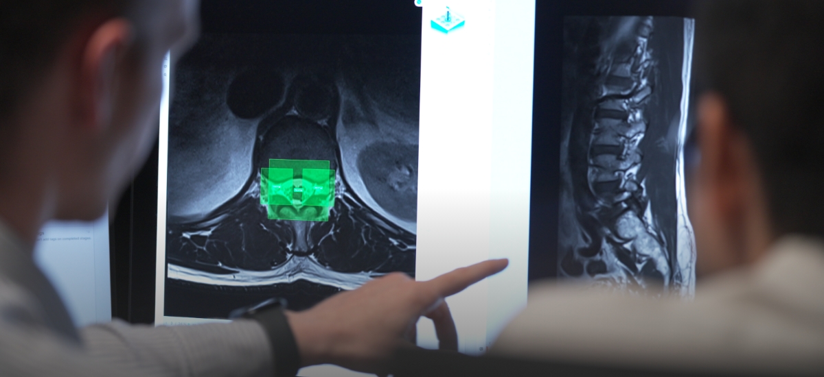 What AI may tell you about your lower back pain