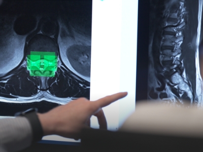 What AI may tell you about your lower back pain